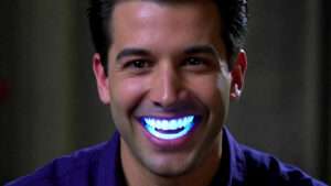 ross geller teeth